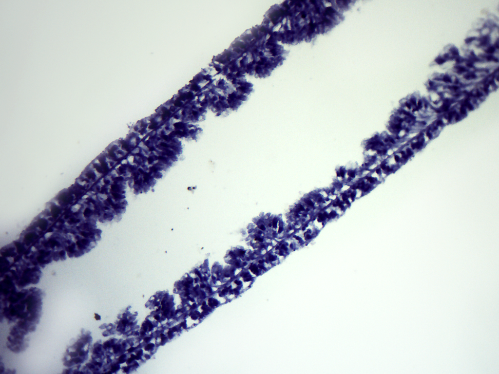 Preparación microscópica de hydra | Zeigen